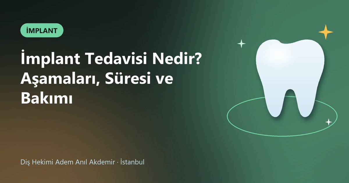 İmplant Tedavisi Nedir? Aşamaları, Süresi ve Bakımı – Dt. Adem Anıl Akdemir blog kapak görseli